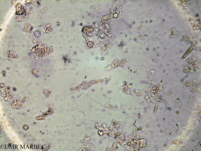 phyto/Brazilian_Amazon_coast/Amazomix_station_18/AMAZOMIX September 2021/Cerataulina pelagica (Am_ST18_int2_cerataulina240903_001)(copy)_thumb.jpg